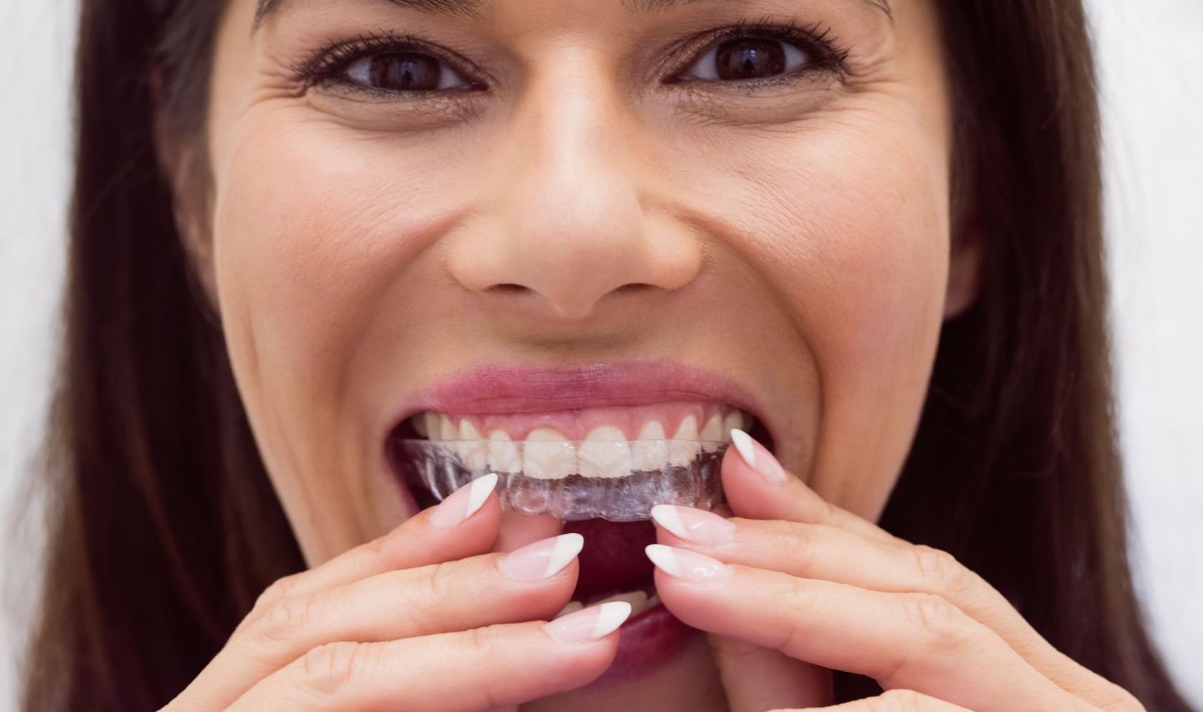 Invisalign In Prairieville, LA